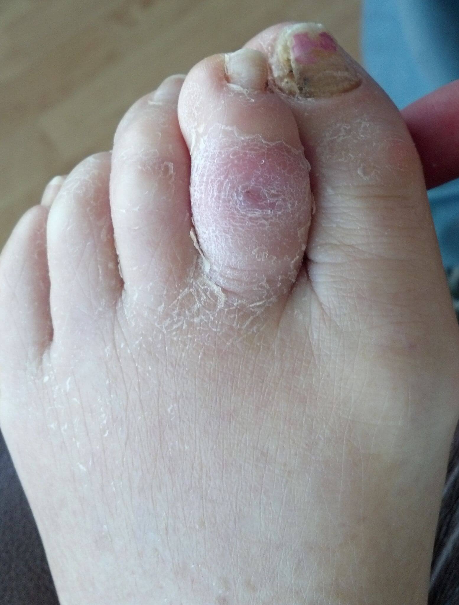 Wounds & Ulcers OC Podiatry