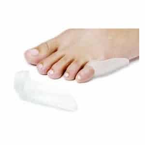 tailor's bunion surgery Orange County, Mission Viejo, Aliso Viejo, Lake Forest, Laguna Hills, Laguna Beach, Irvine, Newport Beach, Tustin, Orange, Anaheim, Fullerton, Santa Ana, Laguna Niguel, Dana Point. 