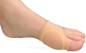Bunion Surgery Expert in Orange County Best Bunion Surgeon in Southern California